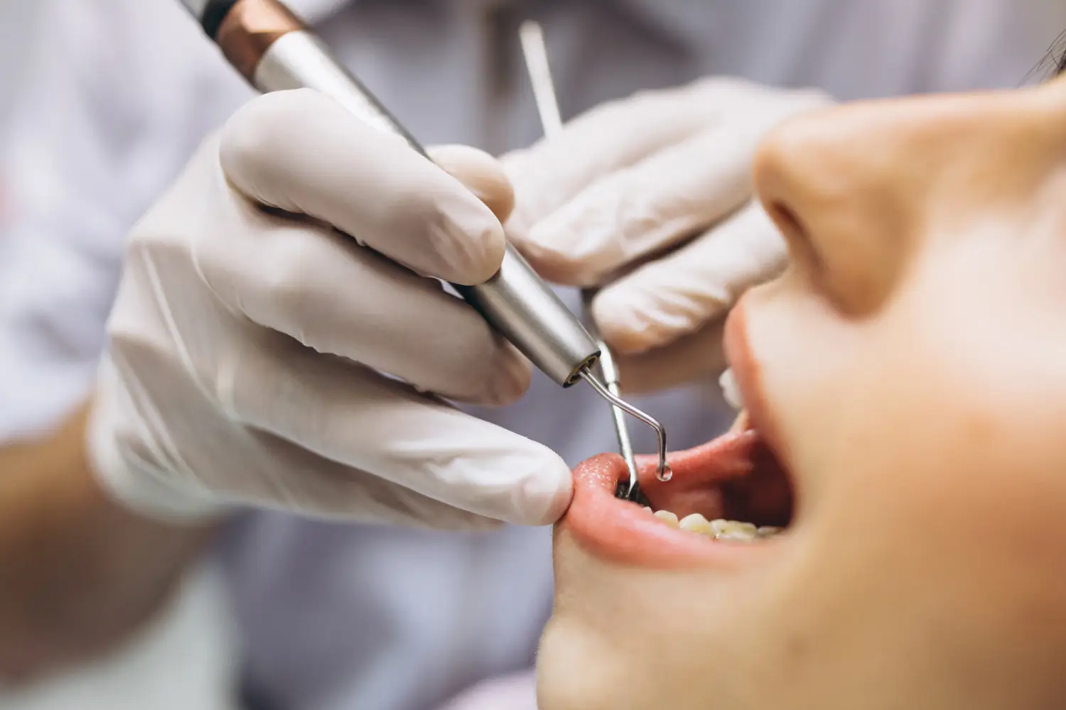 A dentist in gloves uses a dental tool to examine a patient's mouth during a routine dental check-up.